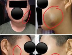 Keluarga Pemuda RD Minta Perhatian Serius APH Dugaan Kasus Pengeroyokkan